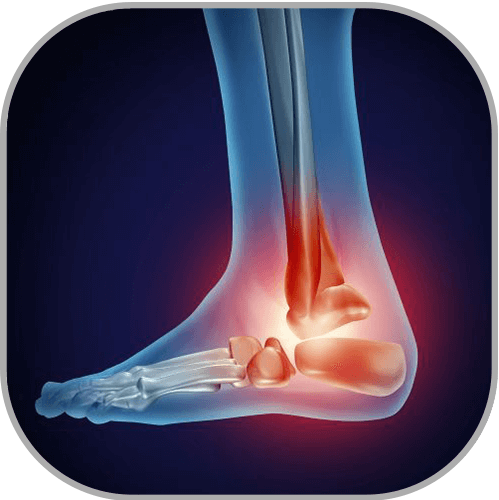 Foot and Ankle Pain Baltimore, Maryland